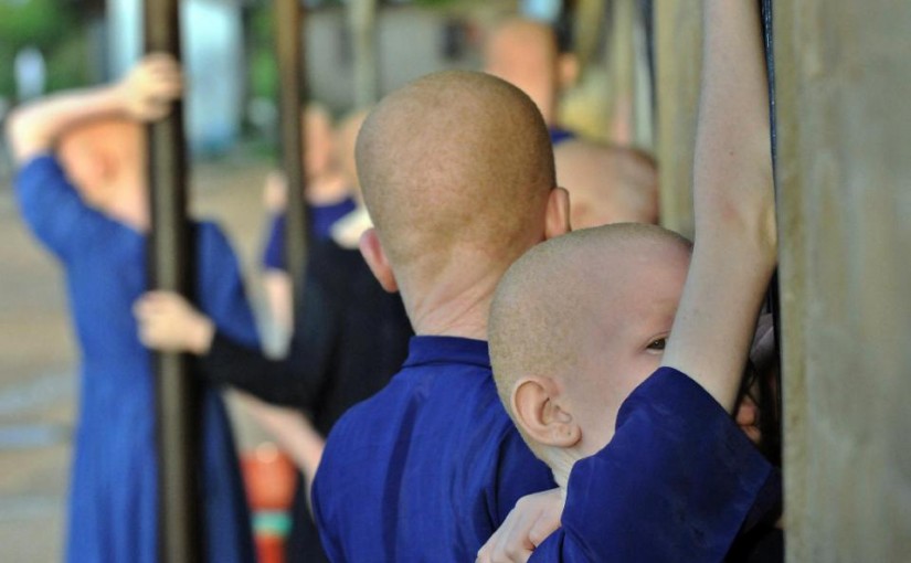 albino_child_tete_kidnappers