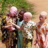 Mhoje_albinochildrenfilefm_photo_jpg