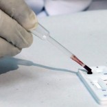 A health agent uses a new test kit that rapidly diagnoses three different mosquito-borne viruses in Sao Paulo, Brazil, January 18, 2016. REUTERS/Rodrigo Paiva