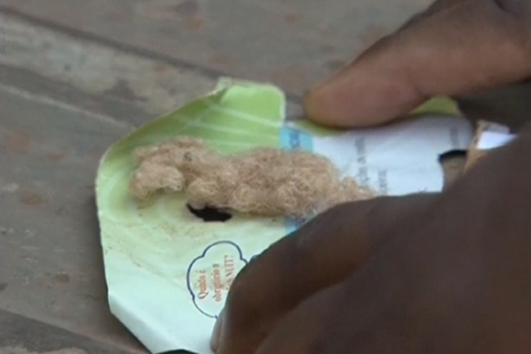 Mhoje_albinohair_photo_jpg