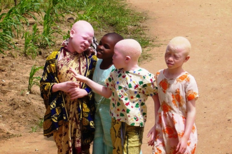 Mhoje_albinos_photo_jpg