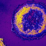 HIV under microscope