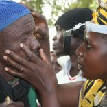 trachoma