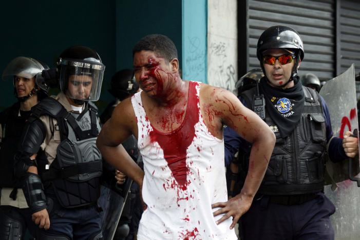 An injured demonstrator stands near police during protests against unpopular leftist President Nicolas Maduro in San Cristobal, Venezuela April 19, 2017. REUTERS/Carlos Eduardo Ramirez