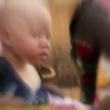 An albino child sits outside the courtroom in Ruyigi, eastern Burundi, May 28, 2009. Prosecutors in Burundi on Thursday asked for life sentences for three people on trial for allegedly murdering albinos to sell their body parts for use in witchcraft.   REUTERS/Jean Pierre Aime Harerimana (BURUNDI CRIME LAW SOCIETY) - RTXOW93