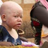 An albino child sits outside the courtroom in Ruyigi, eastern Burundi, May 28, 2009. Prosecutors in Burundi on Thursday asked for life sentences for three people on trial for allegedly murdering albinos to sell their body parts for use in witchcraft.   REUTERS/Jean Pierre Aime Harerimana (BURUNDI CRIME LAW SOCIETY) - RTXOW93