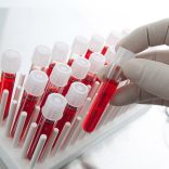 Blood samples in test-tubes