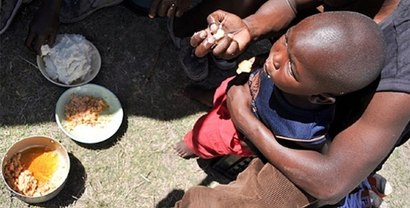 malnutrition.op