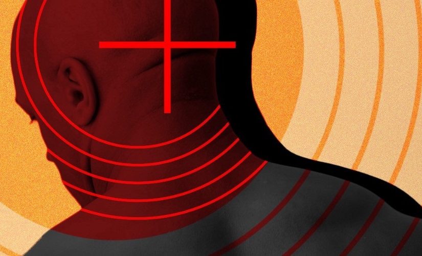 bald.target