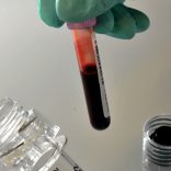 blood.sucker
