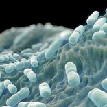 listeriosis1
