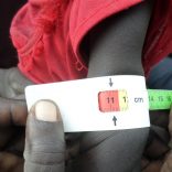 malnutrition.fao