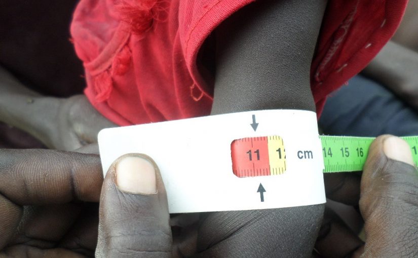 malnutrition.fao
