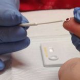 hivtest