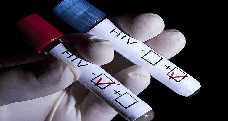 Hiv.not_