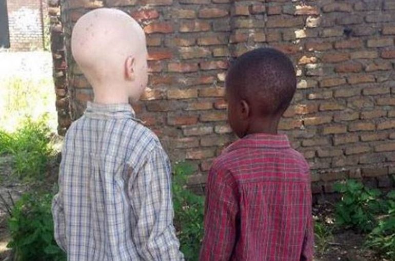 Albinos.moz_.aim_