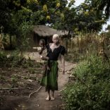 Tanzaniaalb