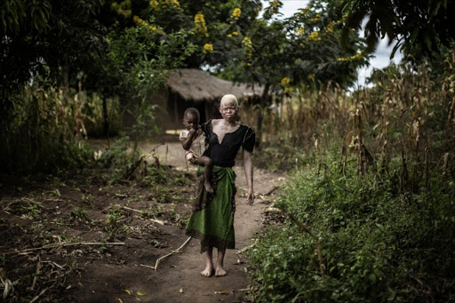 Tanzaniaalb