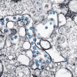 Cvvirus