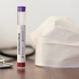 Negativecv