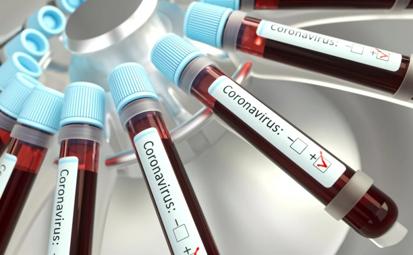 Cvtests