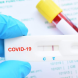 Covid.tests_.rapidtest.lusa_