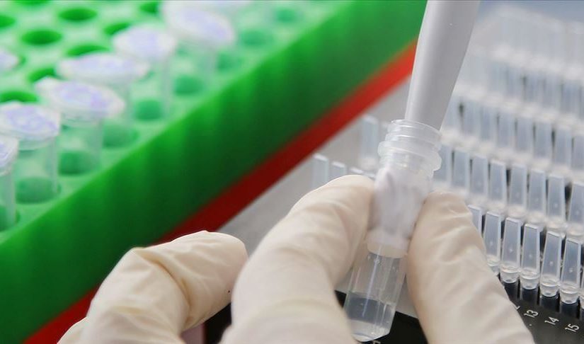 Cvbiohalert