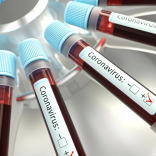Cvtests
