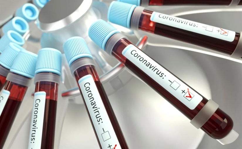 Cvtests