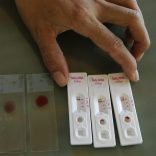 Malaria.tests_.lusa_