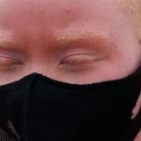 Albinos.moz_.op_