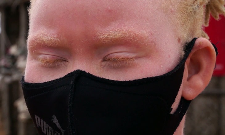 Albinos.moz_.op_