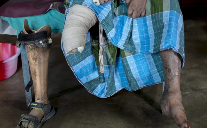 Leprosy.file_.lusa_