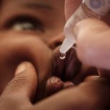 Polio.malawi.afp_