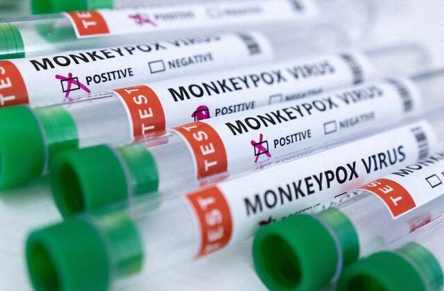 Monkeypox.r.r