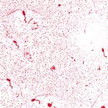 Cholera.vibrio.wmc_
