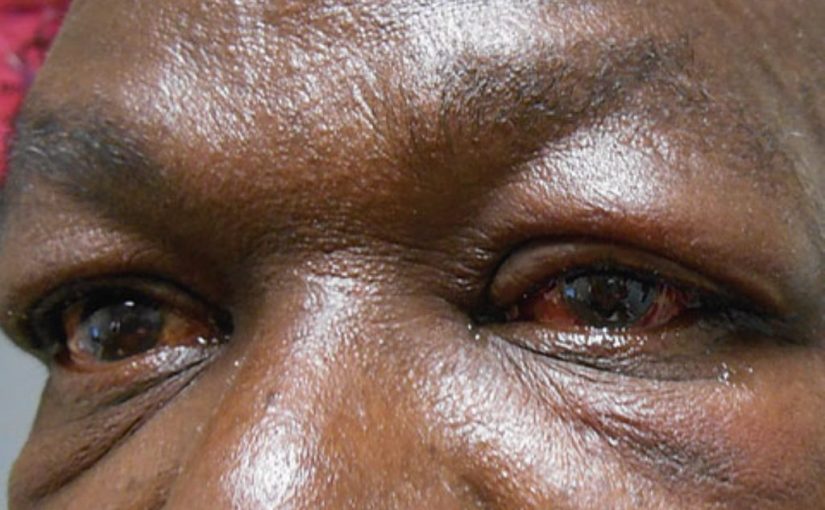 Red-eyes-News-Central-TV-1024x695-1