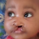 Filecleftlip.file_