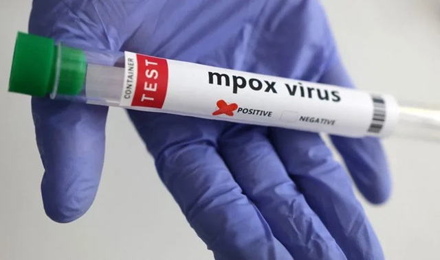 Mpox.positive.r